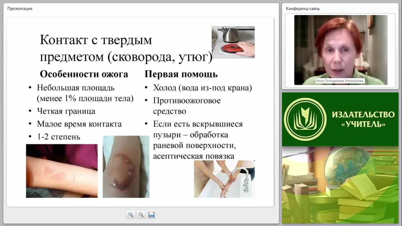 Первая медицинская помощь при термотравме: ожогах, отморожениях, общем замерзании (практикум) - изображение № 6