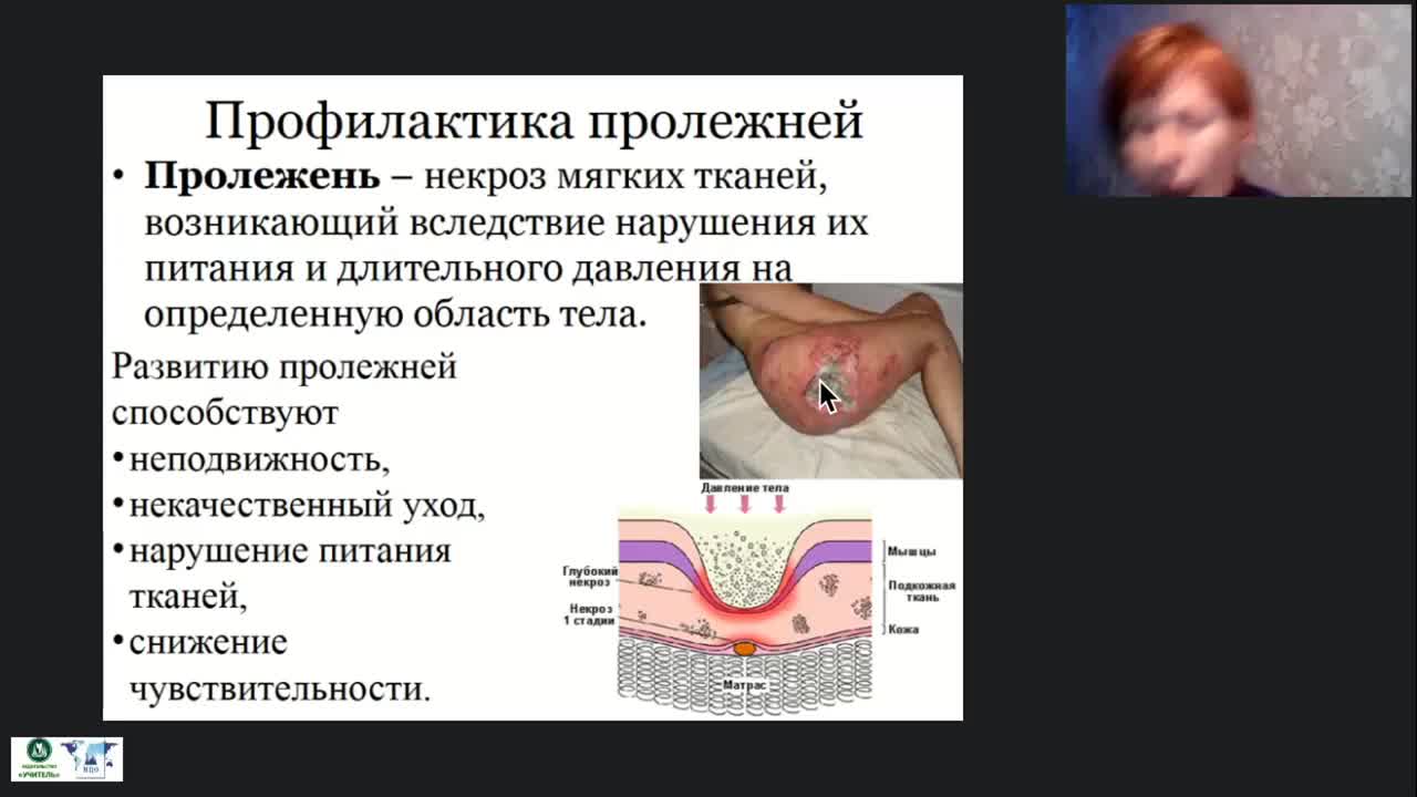 Международный вебинар «Профилактика пролежней, застойной пневмонии, тромбозов и запоров лиц, нуждающихся в постоянном уходе» - изображение № 4