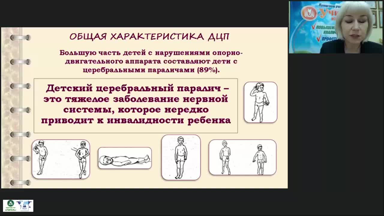 Международный вебинар &quot;Коррекционно-логопедическая работа с детьми с детским церебральным параличом в возрасте от одного года до трех лет&quot; - изображение № 3